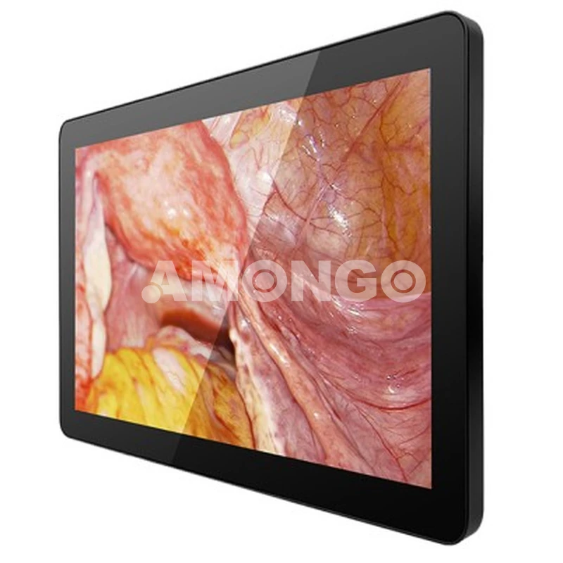 Fabricante de displays médicos AMG 15OPTD01G1